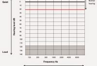 Clinical Audiograms And Hearing Level Db Hl Auditory throughout Blank Audiogram Template Download